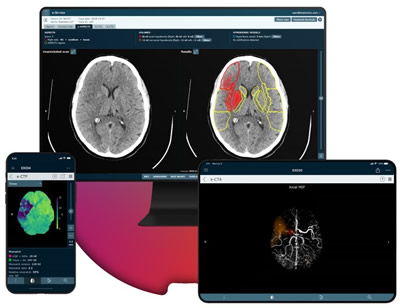 ???AI??????????????????Brainomix??1600????????